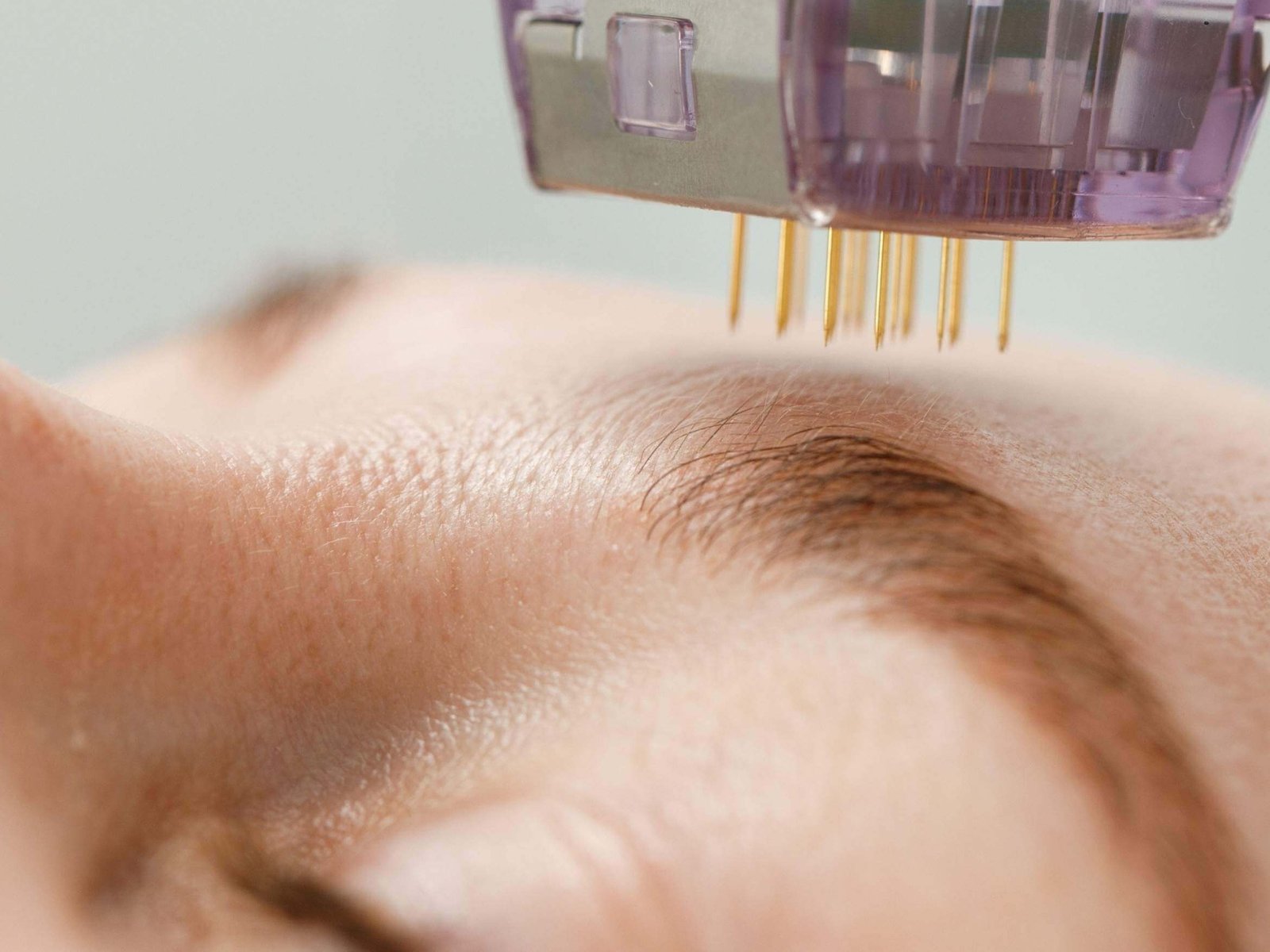 12 dra-teresa-cordero-medicina-estetica-cirugia-facial-armonizacion-calidad-piel-huelva